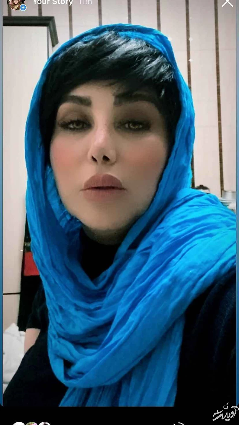 این خانم بازیگر رکورددار جراحی زیبایی ایرانی ! + تصاویری افشاگر !